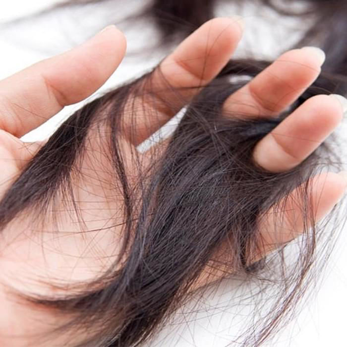 Os principais tipos de queda de cabelo